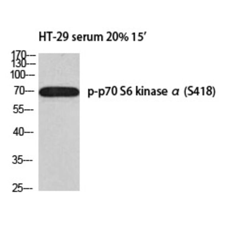 Western blot - p70 S6 kinase α (Phospho-Ser418) Polyclonal Antibody from Signalway Antibody - Antibodies.com