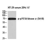 Western blot - p70 S6 kinase α (Phospho-Ser418) Polyclonal Antibody from Signalway Antibody - Antibodies.com