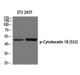 Western blot - Cytokeratin 18 (Phospho-Ser52) Polyclonal Antibody from Signalway Antibody (12270) - Antibodies.com