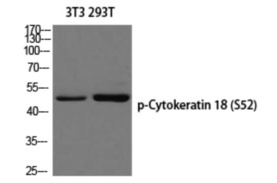 Western blot - Cytokeratin 18 (Phospho-Ser52) Polyclonal Antibody from Signalway Antibody (12270) - Antibodies.com