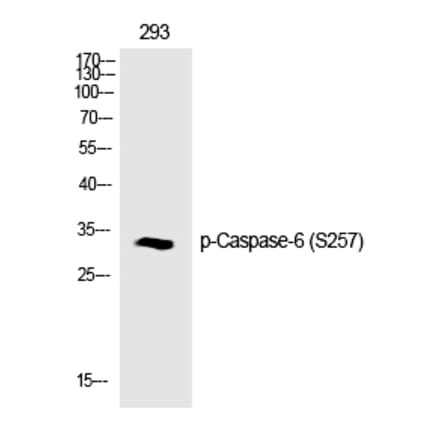 Western blot - Caspase-6 (Phospho-Ser257) Polyclonal Antibody from Signalway Antibody (12187) - Antibodies.com