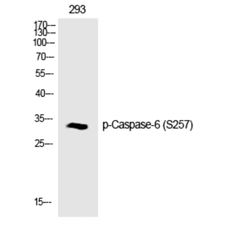 Western blot - Caspase-6 (Phospho-Ser257) Polyclonal Antibody from Signalway Antibody (12187) - Antibodies.com