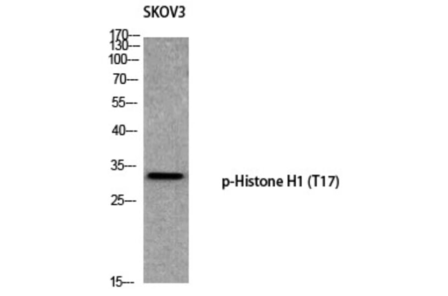 Western blot - Histone H1 (Phospho-Thr17) Polyclonal Antibody from Signalway Antibody (12365) - Antibodies.com