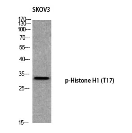 Western blot - Histone H1 (Phospho-Thr17) Polyclonal Antibody from Signalway Antibody (12365) - Antibodies.com