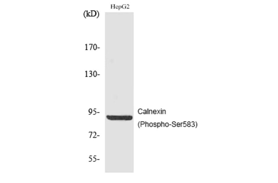 Western blot - Calnexin (Phospho-Ser583) Polyclonal Antibody from Signalway Antibody (12186) - Antibodies.com