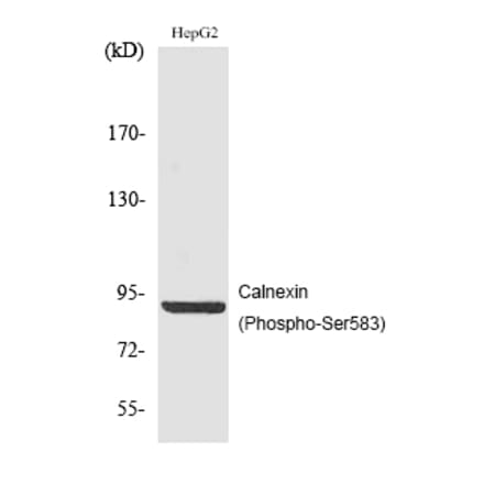 Western blot - Calnexin (Phospho-Ser583) Polyclonal Antibody from Signalway Antibody (12186) - Antibodies.com