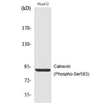 Western blot - Calnexin (Phospho-Ser583) Polyclonal Antibody from Signalway Antibody (12186) - Antibodies.com
