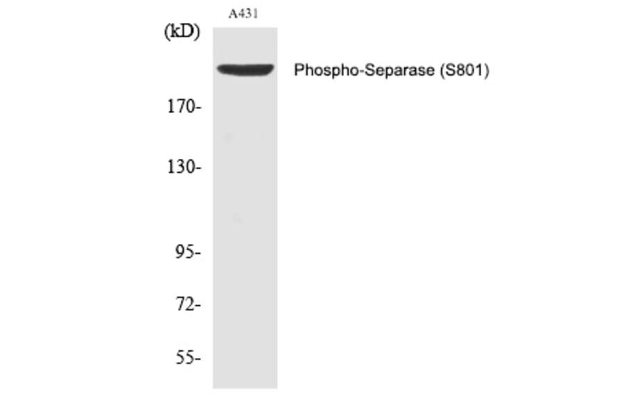 Western blot - Separase (Phospho-Ser801) Polyclonal Antibody from Signalway Antibody (12353) - Antibodies.com