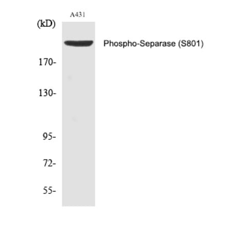 Western blot - Separase (Phospho-Ser801) Polyclonal Antibody from Signalway Antibody (12353) - Antibodies.com