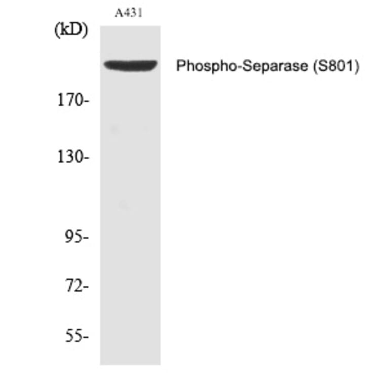 Western blot - Separase (Phospho-Ser801) Polyclonal Antibody from Signalway Antibody (12353) - Antibodies.com