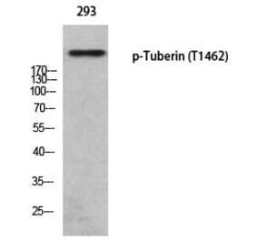 Western blot - Tuberin (Phospho-Thr1462) Polyclonal Antibody from Signalway Antibody (12373) - Antibodies.com