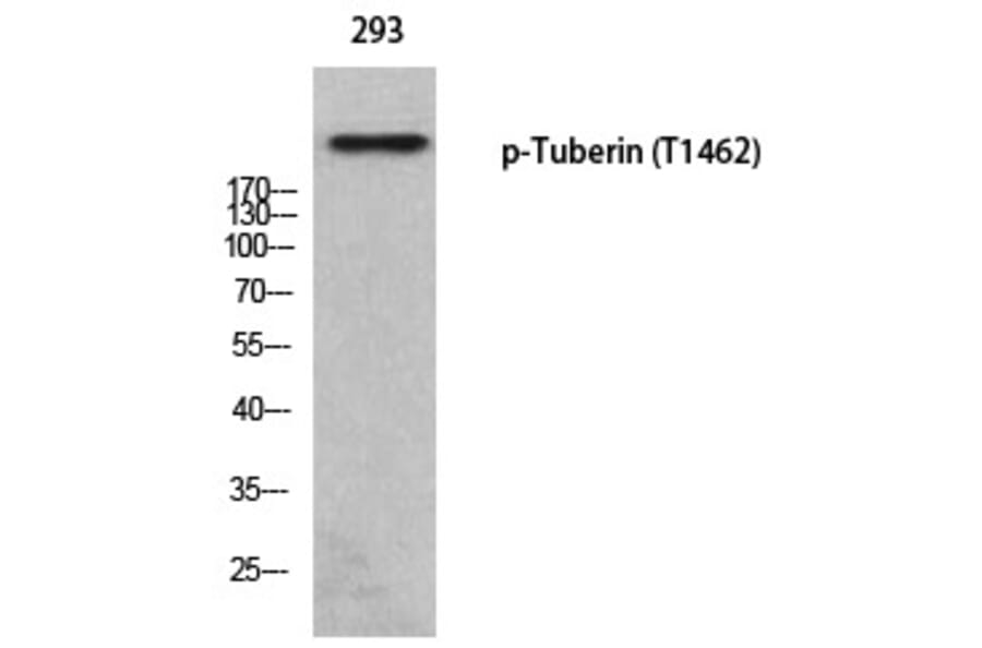 Western blot - Tuberin (Phospho-Thr1462) Polyclonal Antibody from Signalway Antibody (12373) - Antibodies.com