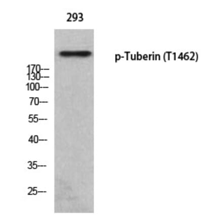 Western blot - Tuberin (Phospho-Thr1462) Polyclonal Antibody from Signalway Antibody (12373) - Antibodies.com