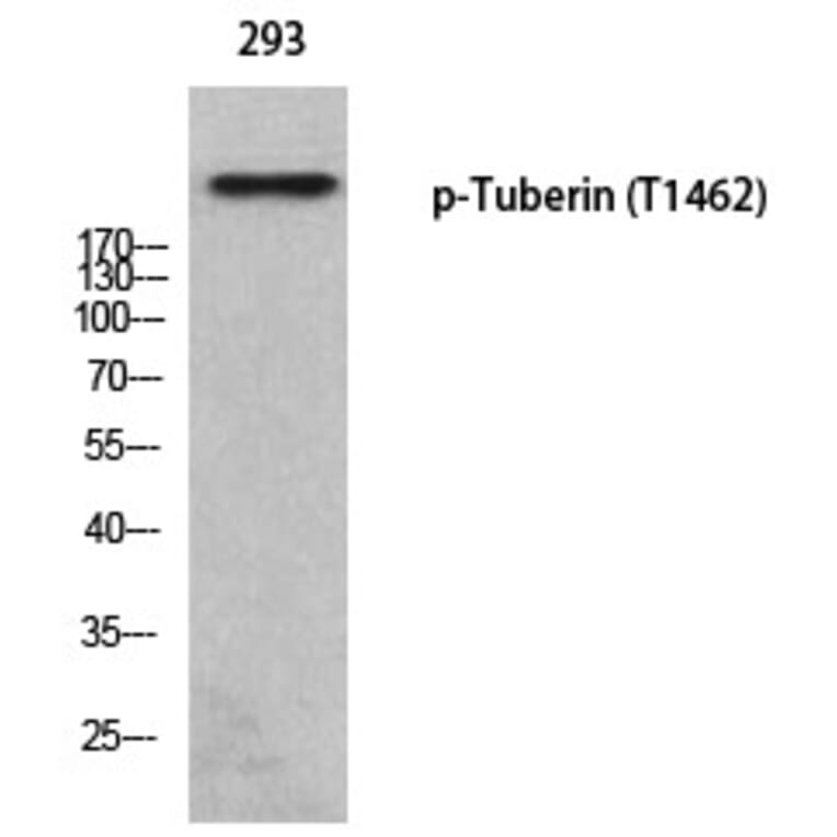 Western blot - Tuberin (Phospho-Thr1462) Polyclonal Antibody from Signalway Antibody (12373) - Antibodies.com