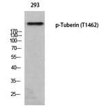 Western blot - Tuberin (Phospho-Thr1462) Polyclonal Antibody from Signalway Antibody (12373) - Antibodies.com