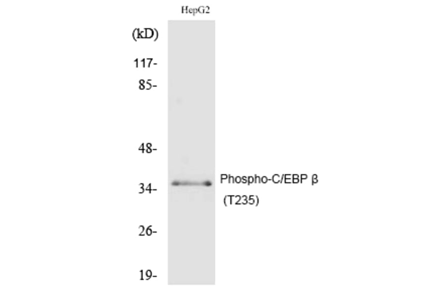 Western blot - C/EBP β (Phospho-Thr235) Polyclonal Antibody from Signalway Antibody (12185) - Antibodies.com
