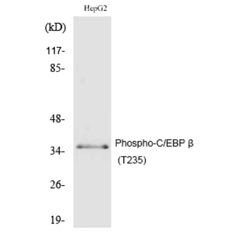Western blot - C/EBP β (Phospho-Thr235) Polyclonal Antibody from Signalway Antibody (12185) - Antibodies.com