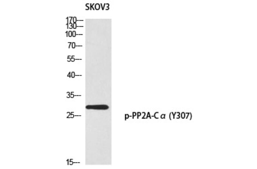 Western blot - PP2A-Cα (Phospho-Tyr307) Polyclonal Antibody from Signalway Antibody (12356) - Antibodies.com
