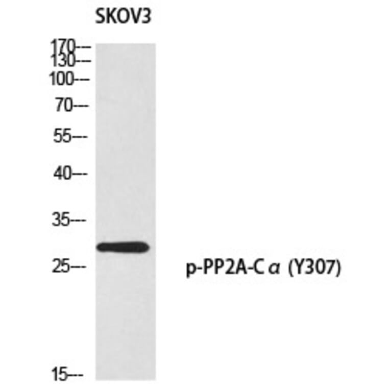 Western blot - PP2A-Cα (Phospho-Tyr307) Polyclonal Antibody from Signalway Antibody (12356) - Antibodies.com