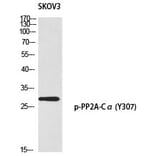 Western blot - PP2A-Cα (Phospho-Tyr307) Polyclonal Antibody from Signalway Antibody (12356) - Antibodies.com