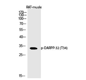 Western blot - DARPP-32 (Phospho-Thr34) Polyclonal Antibody from Signalway Antibody (12369) - Antibodies.com