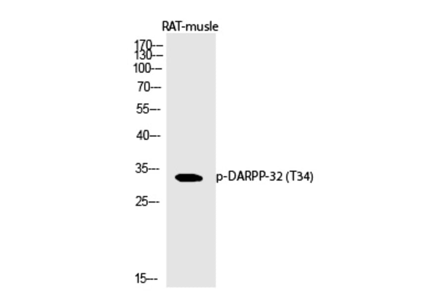 Western blot - DARPP-32 (Phospho-Thr34) Polyclonal Antibody from Signalway Antibody (12369) - Antibodies.com