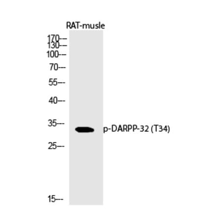 Western blot - DARPP-32 (Phospho-Thr34) Polyclonal Antibody from Signalway Antibody (12369) - Antibodies.com