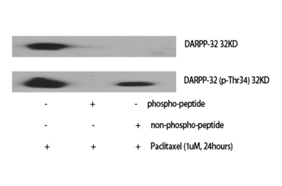 Western blot - DARPP-32 (Phospho-Thr34) Polyclonal Antibody from Signalway Antibody (12369) - Antibodies.com