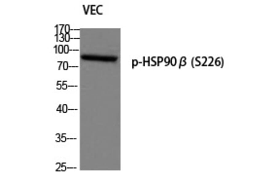 Western blot - HSP90β (Phospho-Ser226) Polyclonal Antibody from Signalway Antibody (12277) - Antibodies.com