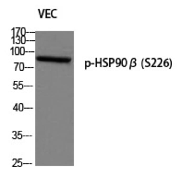 Western blot - HSP90β (Phospho-Ser226) Polyclonal Antibody from Signalway Antibody (12277) - Antibodies.com