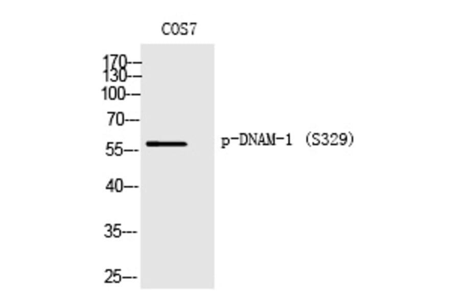 Western blot - DNAM-1 (Phospho-Ser329) Polyclonal Antibody from Signalway Antibody (12361) - Antibodies.com