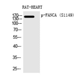 Western blot - FANCA (Phospho-Ser1149) Polyclonal Antibody from Signalway Antibody (12367) - Antibodies.com