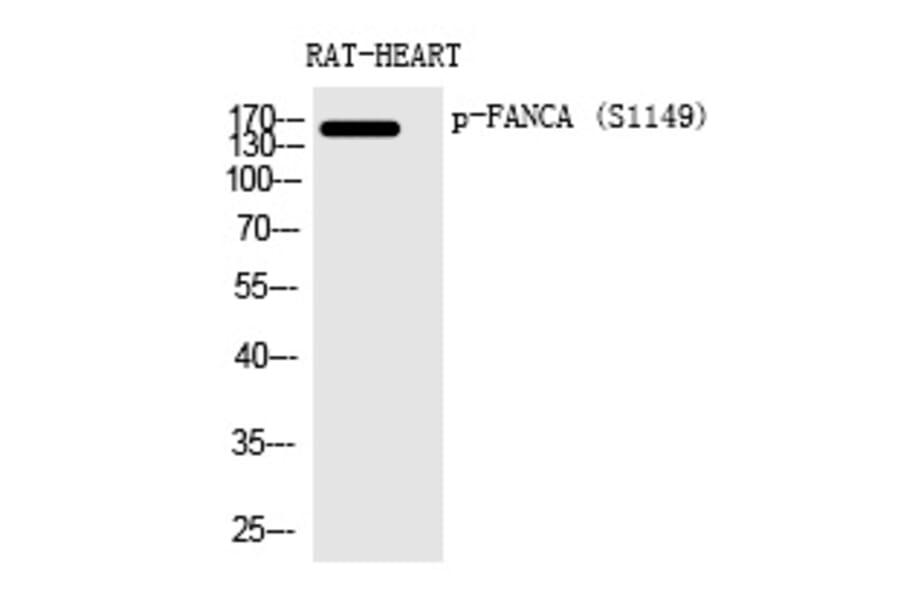 Western blot - FANCA (Phospho-Ser1149) Polyclonal Antibody from Signalway Antibody (12367) - Antibodies.com