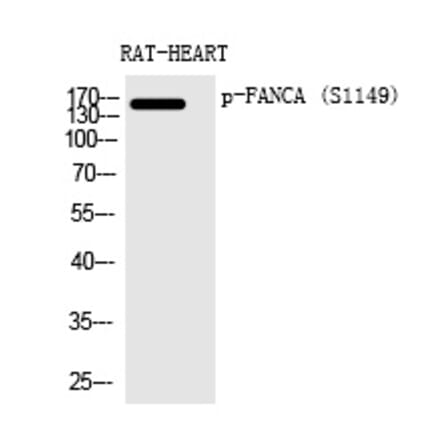 Western blot - FANCA (Phospho-Ser1149) Polyclonal Antibody from Signalway Antibody (12367) - Antibodies.com
