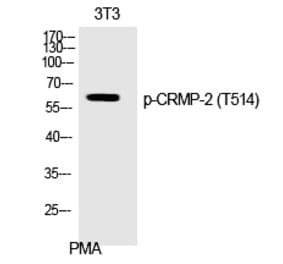 Western blot - CRMP-2 (Phospho-Thr514) Polyclonal Antibody from Signalway Antibody (12368) - Antibodies.com
