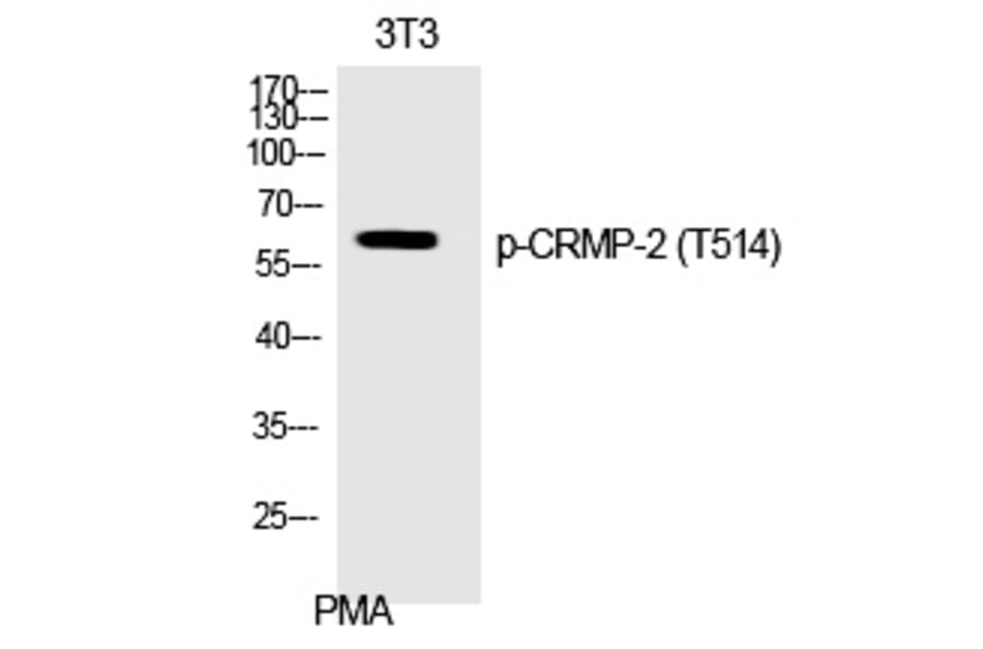 Western blot - CRMP-2 (Phospho-Thr514) Polyclonal Antibody from Signalway Antibody (12368) - Antibodies.com