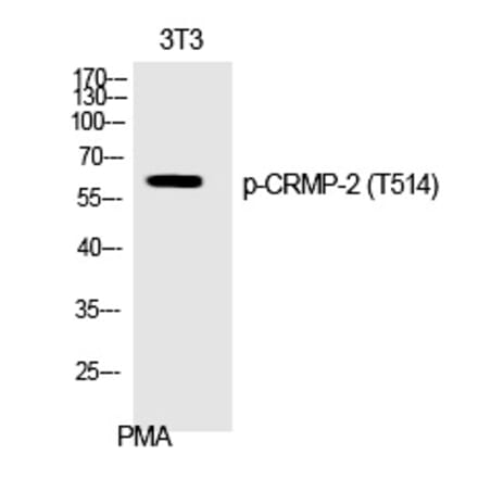 Western blot - CRMP-2 (Phospho-Thr514) Polyclonal Antibody from Signalway Antibody (12368) - Antibodies.com