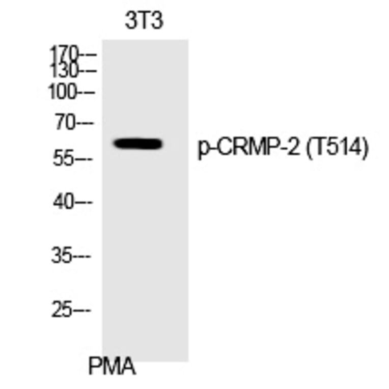 Western blot - CRMP-2 (Phospho-Thr514) Polyclonal Antibody from Signalway Antibody (12368) - Antibodies.com