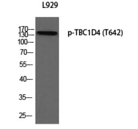 Western blot - TBC1D4 (Phospho-Thr642) Polyclonal Antibody from Signalway Antibody (12385) - Antibodies.com