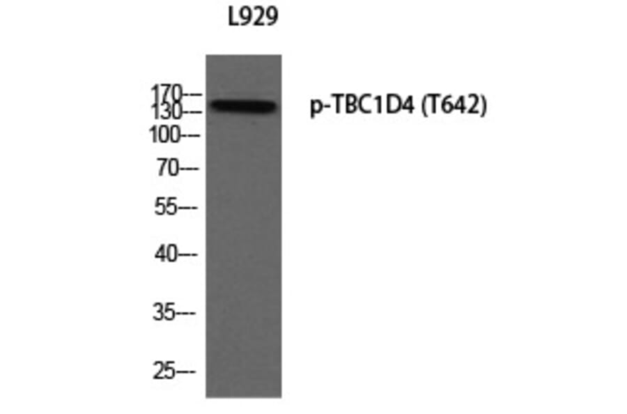 Western blot - TBC1D4 (Phospho-Thr642) Polyclonal Antibody from Signalway Antibody (12385) - Antibodies.com