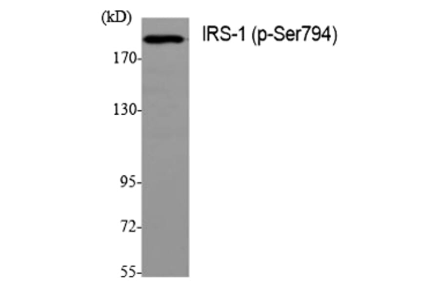 Western blot - IRS-1 (Phospho-Ser794) Polyclonal Antibody from Signalway Antibody (12204) - Antibodies.com