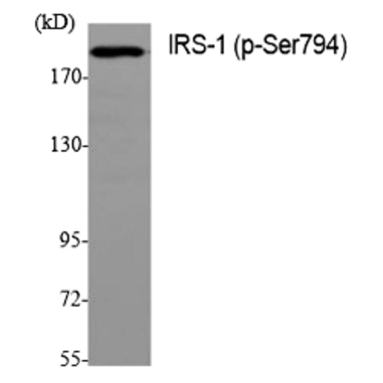 Western blot - IRS-1 (Phospho-Ser794) Polyclonal Antibody from Signalway Antibody (12204) - Antibodies.com