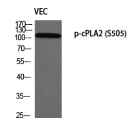 Western blot - cPLA2 (Phospho-Ser505) Polyclonal Antibody from Signalway Antibody (12349) - Antibodies.com