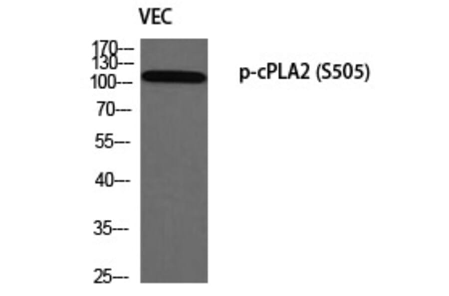 Western blot - cPLA2 (Phospho-Ser505) Polyclonal Antibody from Signalway Antibody (12349) - Antibodies.com