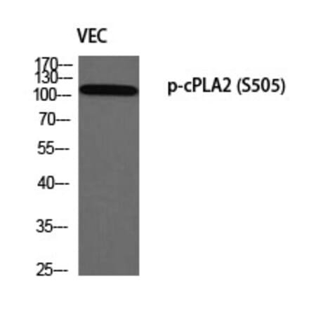 Western blot - cPLA2 (Phospho-Ser505) Polyclonal Antibody from Signalway Antibody (12349) - Antibodies.com