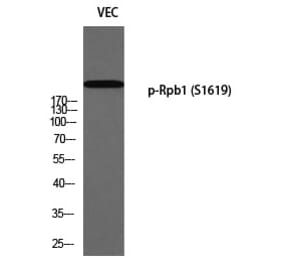 Western blot - Rpb1 (Phospho-Ser1619) Polyclonal Antibody from Signalway Antibody (12352) - Antibodies.com