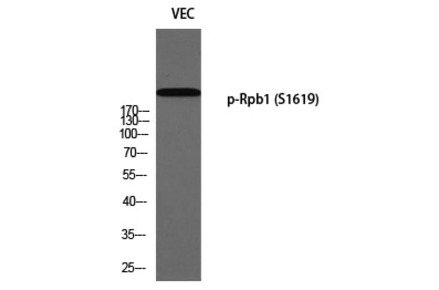 Western blot - Rpb1 (Phospho-Ser1619) Polyclonal Antibody from Signalway Antibody (12352) - Antibodies.com