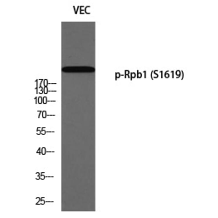 Western blot - Rpb1 (Phospho-Ser1619) Polyclonal Antibody from Signalway Antibody (12352) - Antibodies.com