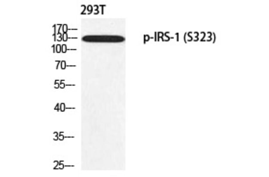 Western blot - IRS-1 (Phospho-Ser323) Polyclonal Antibody from Signalway Antibody (12354) - Antibodies.com