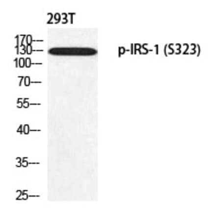 Western blot - IRS-1 (Phospho-Ser323) Polyclonal Antibody from Signalway Antibody (12354) - Antibodies.com